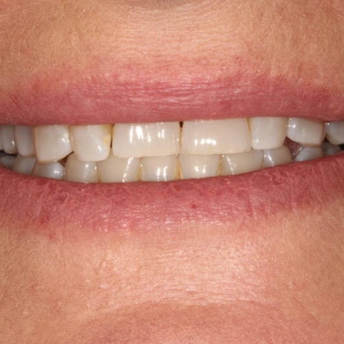 before dental care treatment
