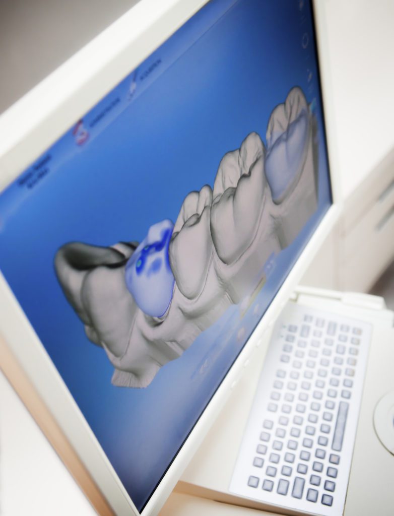 digital dentistry in annapolis md