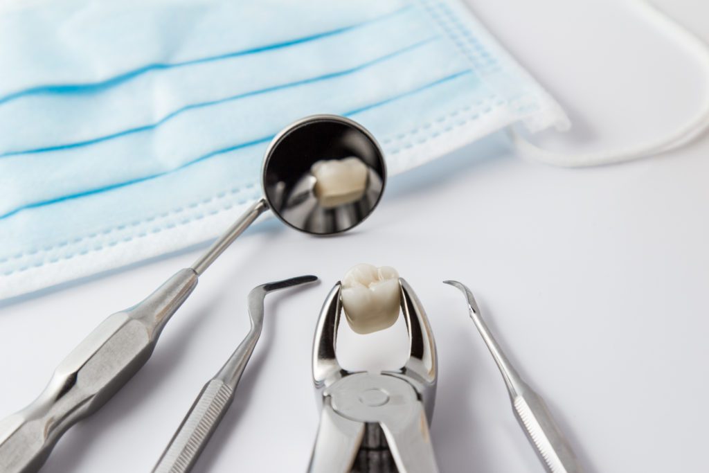 Dental Extraction in Annapolis, Maryland